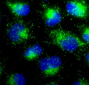 Stained for lysosomes (green) and DNA (blue). Photo credit: Louise Walker, 2011. (This is from the very beginning of my PhD. Which is why is rubbish. Well, I'm not going to use a thesis-quality one, am I?)