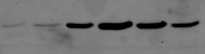 Showing the protein Tsg101 after elution from a gel filtration column, if you're really that interested. Credit: Louise Walker, 2011