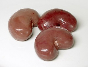 Kidney 1