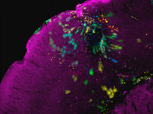 The injury site (dark sphere) can be seen surrounded by multi-coloured astrocytes. From: Martín-López et al. PLoS ONE 8(9) .