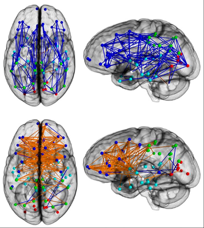 The top shows the most interconnected male regions, the bottom shows the most interconnected female regions. From: Ingalhalikar et al. PNAS (online publication before print).