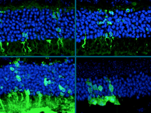 Host retina cells are shown in blue, injected new photoreceptive cells are shown in green. The top left is a healthy mouse. The next three images show three different types of genetic blindness models in mice – all show integration of the injected cells. From Barber et al. PNAS 110(1): 354-359 