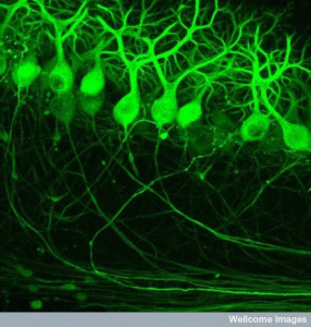 Fluorescent micrograph showing the cerebellar network of purkinje neurons from a mouse imaged using 2-photon microscopy. The neurons are visualised by labelling the cells with green fluorescent protein (GFP). Purkinje cells are specialised neurons found in layers within the cerebellum (at the back of the brain). In humans they are one of the longest types of neurons in the brain and are involved in transmitting motor output from the cerebellum.