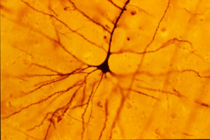 A human neocortical pyramidal neuron stained via Golgi technique. Notice the apical dendrite extending vertically above the soma and the numerous basal dendrites radiating laterally from the base of the cell body.